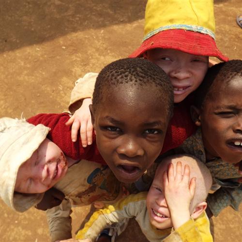 Microproyectos de cooperación: Tanzania. educación y salud con población albina refugiada
